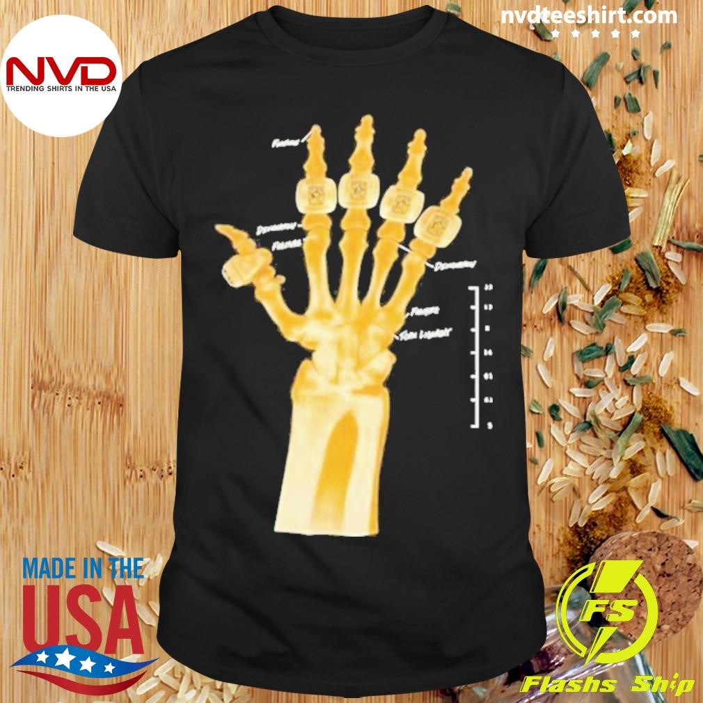 Skeleton Kobe Bryant Broken Not Beaten X Ray Irt 2024 Shirt